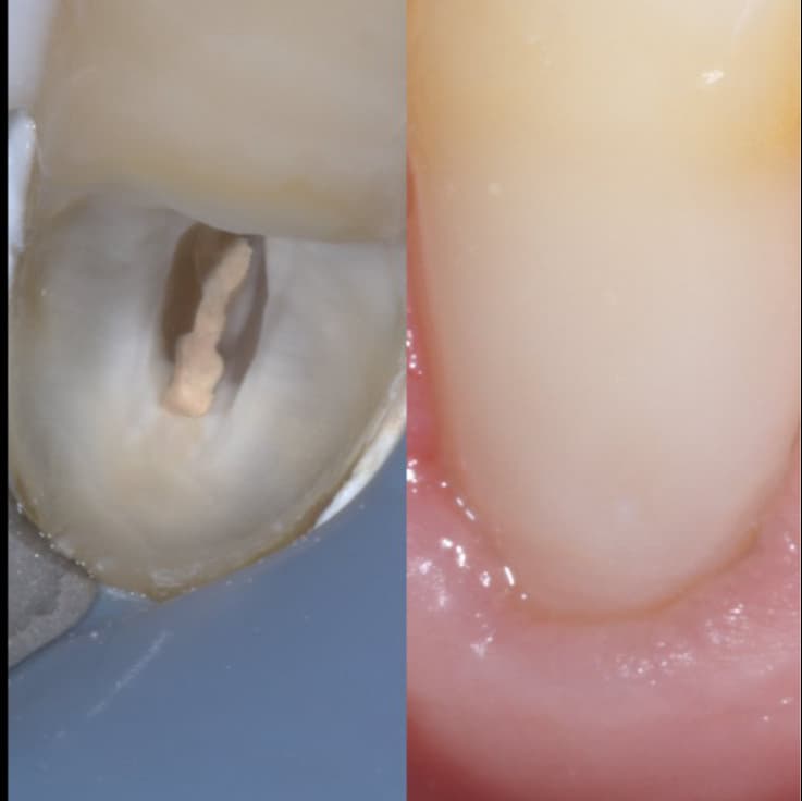 Canine Journey, Endo+ Resto